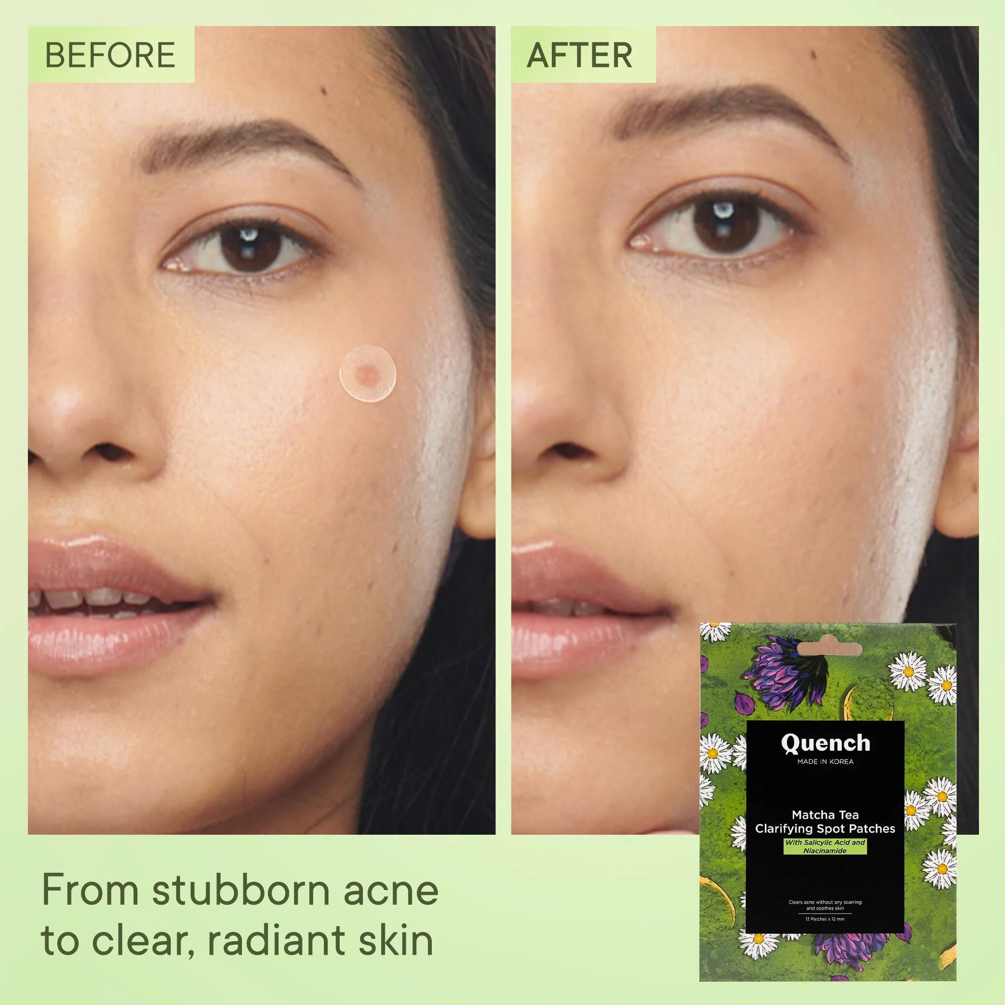 Matcha Tea Clarifying Acne Patches - Image 5